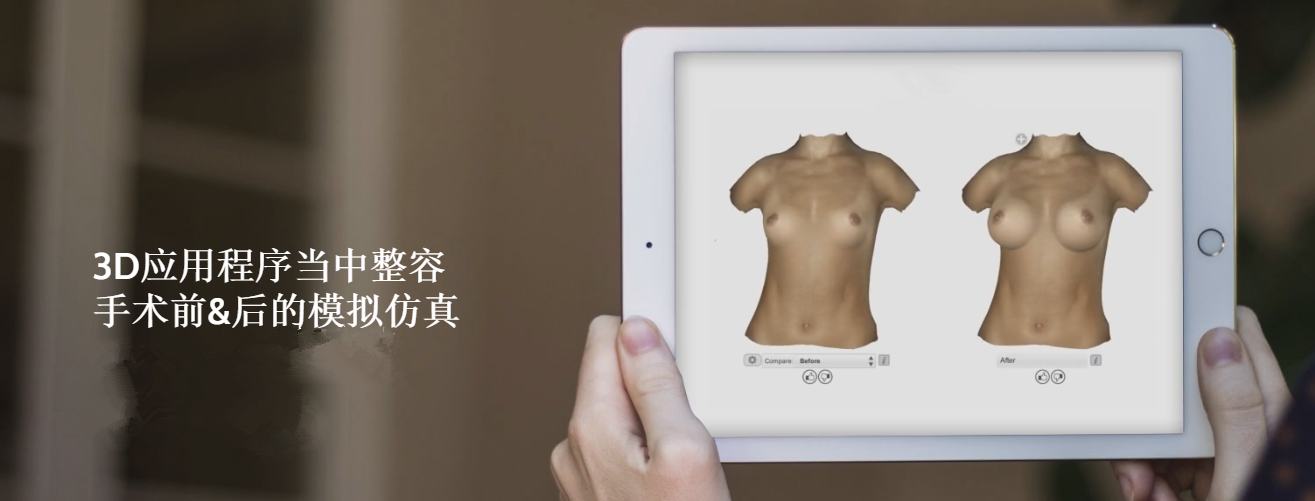北京大星医疗整形3D扫描软硬件开发项目寻融资